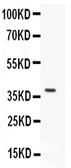 Anti-Stra8 antibody used in Western Blot (WB). GTX11870