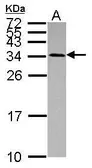 Anti-USE1 antibody used in Western Blot (WB). GTX118767