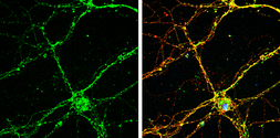 Anti-RAB26 antibody [N2C3-2] used in Immunocytochemistry/ Immunofluorescence (ICC/IF). GTX118872