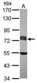 Anti-RC74 antibody [N1N2], N-term used in Western Blot (WB). GTX118946