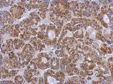 Anti-ZSWIM2 antibody [N1N3] used in IHC (Paraffin sections) (IHC-P). GTX118963