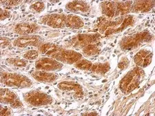 Anti-MRPS23 antibody used in IHC (Paraffin sections) (IHC-P). GTX119033