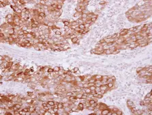 Anti-PITPNB antibody used in IHC (Paraffin sections) (IHC-P). GTX119123