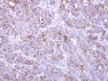 Anti-FBL8 antibody used in IHC (Paraffin sections) (IHC-P). GTX119171