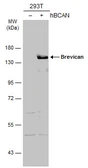 Anti-Brevican antibody [N1N2], N-term used in Western Blot (WB). GTX119374