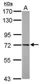 Anti-DDX43 antibody used in Western Blot (WB). GTX119498