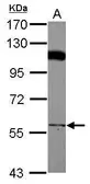 Anti-PCYOX1 antibody used in Western Blot (WB). GTX119652