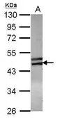 Anti-ZNF439 antibody [N2C1], Internal used in Western Blot (WB). GTX119735