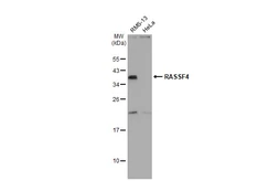 Anti-RASSF4 antibody [N1C1] used in Western Blot (WB). GTX119774