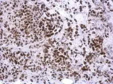 Anti-C10orf93 antibody [N1], N-term used in IHC (Paraffin sections) (IHC-P). GTX119794
