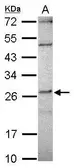 Anti-DPCD antibody [N1C3] used in Western Blot (WB). GTX119808