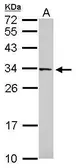 Anti-FAM78B antibody [N2C3] used in Western Blot (WB). GTX119928
