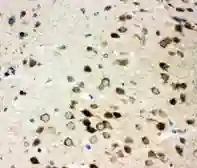 Anti-Integrin alpha 3 antibody used in IHC (Paraffin sections) (IHC-P). GTX11993