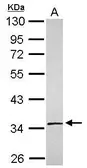 Anti-SLC25A36 antibody [N1C3] used in Western Blot (WB). GTX119934