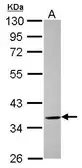 Anti-ELMOD1 antibody [N2C3] used in Western Blot (WB). GTX120004