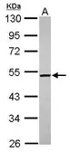 Anti-C2orf65 antibody [N2C2], Internal used in Western Blot (WB). GTX120030