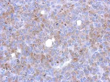 Anti-DDEFL1 antibody [N3C2], Internal used in IHC (Paraffin sections) (IHC-P). GTX120116