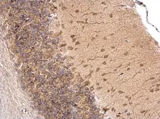 Anti-LSM14A antibody used in IHC (Paraffin sections) (IHC-P). GTX120187