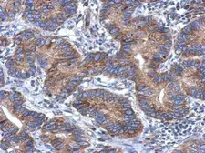 Anti-CCDC70 antibody [N1C3] used in IHC (Paraffin sections) (IHC-P). GTX120333