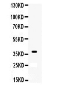 Anti-XRCC3 antibody used in Western Blot (WB). GTX12050