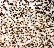 Anti-MCM2 antibody used in Immunocytochemistry/ Immunofluorescence (ICC/IF). GTX12059