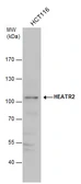 Anti-HEATR2 antibody used in Western Blot (WB). GTX120669