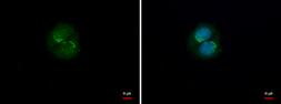 Anti-SKT antibody used in Immunocytochemistry/ Immunofluorescence (ICC/IF). GTX120685