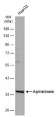 Anti-Agmatinase antibody used in Western Blot (WB). GTX120707