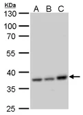 Anti-CCDC137 antibody used in Western Blot (WB). GTX120753