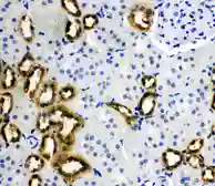 Anti-RKIP antibody used in IHC (Paraffin sections) (IHC-P). GTX12076