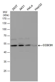 Anti-CCDC91 antibody used in Western Blot (WB). GTX120766