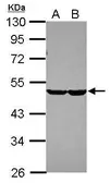 Anti-CHST7 antibody [N2C1], Internal used in Western Blot (WB). GTX120778