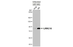 Anti-LRRC15 antibody [N1N3] used in Western Blot (WB). GTX120895