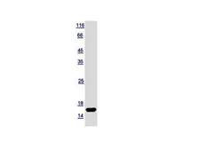 Human MED10 protein, His tag. GTX120912-pro
