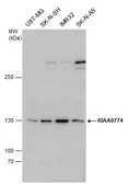 Anti-MTUS2 antibody used in Western Blot (WB). GTX120919