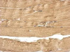 Anti-TBC1D15 antibody used in IHC (Paraffin sections) (IHC-P). GTX121081
