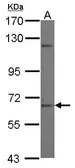 Anti-ZNF334 antibody [N1C1] used in Western Blot (WB). GTX121366