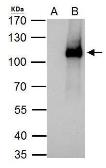 Anti-ELP2 antibody [N3C2], Internal used in Immunoprecipitation (IP). GTX121449