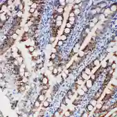 Anti-FER antibody used in IHC (Paraffin sections) (IHC-P). GTX12150