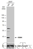 Anti-RBM4 antibody used in Western Blot (WB). GTX121565