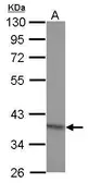 Anti-RG9MTD2 antibody used in Western Blot (WB). GTX121571