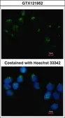 Anti-EMB antibody [N3C3] used in Immunocytochemistry/ Immunofluorescence (ICC/IF). GTX121952