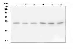 Anti-FSTL3 antibody used in Western Blot (WB). GTX12198