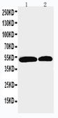 Anti-NOXA1 antibody used in Western Blot (WB). GTX12206