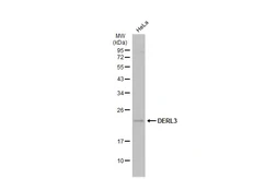 Anti-DERL3 antibody [N3C2], Internal used in Western Blot (WB). GTX122163