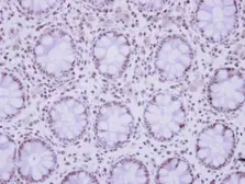 Anti-ZNF418 antibody [N2C1], Internal used in IHC (Paraffin sections) (IHC-P). GTX122331