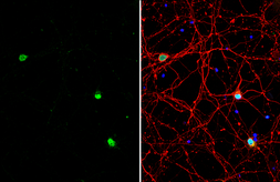 Anti-BAF53B antibody used in Immunocytochemistry/ Immunofluorescence (ICC/IF). GTX122920