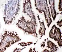 Anti-RGS3 antibody used in IHC (Paraffin sections) (IHC-P). GTX12297