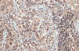 Anti-ULBP1 antibody [N1C3] used in IHC (Paraffin sections) (IHC-P). GTX123021