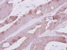 Anti-Atpalpha antibody [N2C1], Internal used in IHC (Paraffin sections) (IHC-P). GTX123137